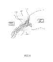 Fig. 04 - METHODS AND APPARATUS FOR REDUCING LOCALIZED CIRCULATORY SYSTEM PRESSURE