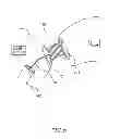 Fig. 05 - METHODS AND APPARATUS FOR REDUCING LOCALIZED CIRCULATORY SYSTEM PRESSURE