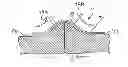 Fig. 01 - Force Modulating Tissue Bridge