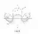 Fig. 06 - Force Modulating Tissue Bridge