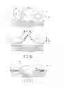 Fig. 07 - Force Modulating Tissue Bridge