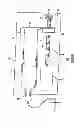 Fig. 02 - Methods and apparatuses for detecting occlusions in an ambulatory infusion pump