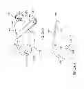 Fig. 25 - Methods and apparatuses for detecting occlusions in an ambulatory infusion pump