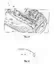 Fig. 16 - Fluid delivery device and transcutaneous access tool with blood glucose monitoring for use therewith