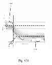Fig. 20 - Shroud deployment in automatic injection devices