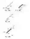 Fig. 16 - Deployment mechanism for body vessel insertion devices