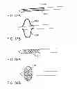 Fig. 19 - Deployment mechanism for body vessel insertion devices