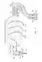Fig. 02 - Ocular infusion system