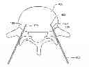Fig. 01 - Electrosurgical tissue treatment device