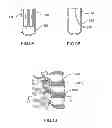 Fig. 09 - Electrosurgical tissue treatment device