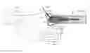 Fig. 01 - Apparatus and methods for fracture repair