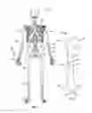 Fig. 05 - Apparatus and methods for fracture repair