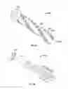 Fig. 40 - Apparatus and methods for fracture repair