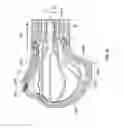Fig. 48 - Apparatus and methods for fracture repair