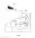 Fig. 53 - Apparatus and methods for fracture repair