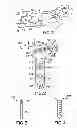 Fig. 02 - Volar fixation system with fixed-angle multi-hole drill guide