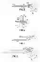 Fig. 03 - Volar fixation system with fixed-angle multi-hole drill guide