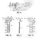 Fig. 04 - Volar fixation system with fixed-angle multi-hole drill guide