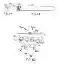 Fig. 05 - Volar fixation system with fixed-angle multi-hole drill guide