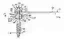 Fig. 01 - Bone plates, screws, and instruments