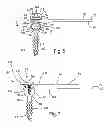 Fig. 03 - Bone plates, screws, and instruments