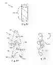 Fig. 12 - Bone plates, screws, and instruments