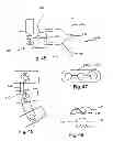 Fig. 14 - Bone plates, screws, and instruments