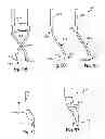 Fig. 15 - Bone plates, screws, and instruments