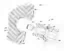 Fig. 01 - Systems and methods for altering the surface of a bone