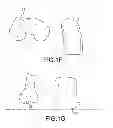 Fig. 08 - Unicompartmental customized arthroplasty cutting jigs