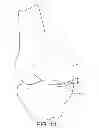Fig. 13 - Unicompartmental customized arthroplasty cutting jigs