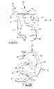 Fig. 15 - Unicompartmental customized arthroplasty cutting jigs
