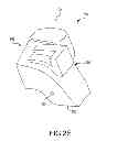 Fig. 16 - Unicompartmental customized arthroplasty cutting jigs