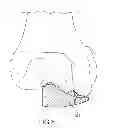 Fig. 23 - Unicompartmental customized arthroplasty cutting jigs