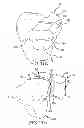 Fig. 26 - Unicompartmental customized arthroplasty cutting jigs