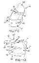 Fig. 27 - Unicompartmental customized arthroplasty cutting jigs