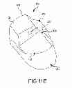 Fig. 28 - Unicompartmental customized arthroplasty cutting jigs