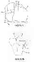 Fig. 29 - Unicompartmental customized arthroplasty cutting jigs