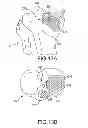 Fig. 30 - Unicompartmental customized arthroplasty cutting jigs