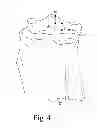 Fig. 05 - Customized patient-specific orthopaedic pin guides