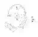 Fig. 06 - Customized patient-specific orthopaedic pin guides