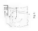 Fig. 07 - Customized patient-specific orthopaedic pin guides