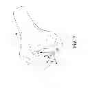 Fig. 08 - Customized patient-specific orthopaedic pin guides