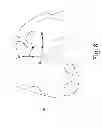 Fig. 09 - Customized patient-specific orthopaedic pin guides