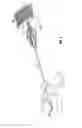 Fig. 05 - Methods and apparatus for treating vertebral fractures
