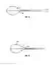 Fig. 17 - Methods and apparatus for treating vertebral fractures