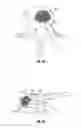 Fig. 22 - Methods and apparatus for treating vertebral fractures