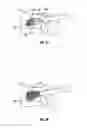 Fig. 23 - Methods and apparatus for treating vertebral fractures