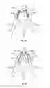 Fig. 28 - Methods and apparatus for treating vertebral fractures