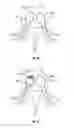 Fig. 30 - Methods and apparatus for treating vertebral fractures
